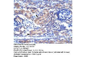 Human kidney (KCNAB3 Antikörper  (N-Term))