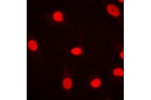Immunofluorescent analysis of MZF1 staining in HeLa cells.