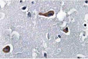 Immunohistochemistry (IHC) analyzes of MAP-2 antibody in paraffin-embedded human brain tissue. (MAP2 Antikörper)