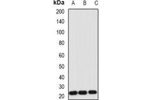 Western blot analysis of IL-1RA expression in Hela (A), NIH3T3 (B), HL60 (C) whole cell lysates. (IL1RN Antikörper)