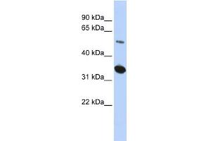 WB Suggested Anti-KIAA0157 Antibody Titration: 0. (FAM175B Antikörper  (Middle Region))