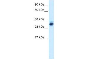 WB Suggested Anti-ZNF654 Antibody Titration:  0. (ZNF654 Antikörper  (Middle Region))