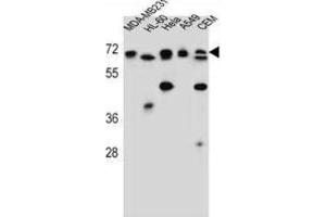 Western Blotting (WB) image for anti-acetylserotonin O-Methyltransferase-Like (ASMTL) antibody (ABIN2997228) (ASMTL Antikörper)