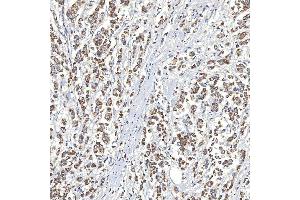 IHC analysis of SLC20A1 using anti-SLC20A1 antibody (ABIN7602463).
