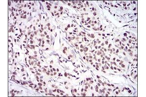 Immunohistochemistry (IHC) image for anti-X-Ray Repair Complementing Defective Repair in Chinese Hamster Cells 6 (XRCC6) (AA 6-214) antibody (ABIN5542547)