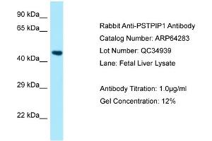 Western Blotting (WB) image for anti-Proline-serine-threonine Phosphatase Interacting Protein 1 (PSTPIP1) (N-Term) antibody (ABIN2789789)