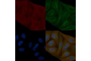 Annexin A2 Mouse Monoclonal Antibody staining Hela cells by IF/ICC. (Annexin A2 Antikörper  (Internal Region))