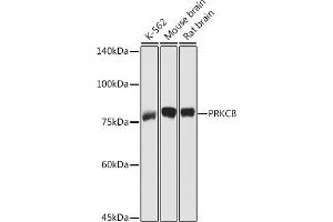 Western blot analysis of extracts of various cell lines, using PRKCB antibody (ABIN6128462, ABIN6146199, ABIN6146201 and ABIN6217699) at 1:1000 dilution. (PKC beta Antikörper  (AA 1-270))
