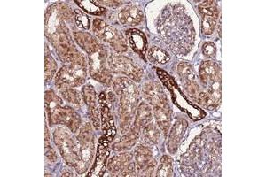 Immunohistochemical staining of human kidney with RPS15A polyclonal antibody  shows strong cytoplasmic positivity in cells in tubules at 1:10-1:20 dilution.