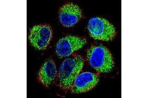 Immunofluorescence (IF) image for anti-TBC1 Domain Family, Member 13 (TBC1D13) (AA 83-113), (Middle Region) antibody (ABIN955091)