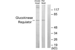 Western blot analysis of extracts from mouse heart cells and rat heart cells, using Glucokinase Regulator antibody. (GCKR Antikörper  (Internal Region))