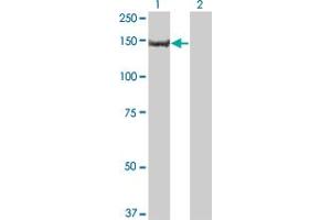 Western Blot analysis of PIK3R4 expression in transfected 293T cell line by PIK3R4 monoclonal antibody (M03), clone 1G12. (PIK3R4 Antikörper  (AA 1259-1358))