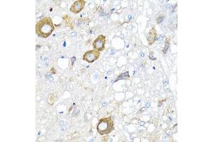 Immunohistochemistry of paraffin-embedded rat brain using MGP antibody at dilution of 1:100 (40x lens). (MGP Antikörper)