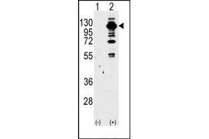 Image no. 1 for anti-Phosphoinositide-3-Kinase, Catalytic, gamma Polypeptide (PIK3CG) (Middle Region) antibody (ABIN360713) (PIK3 gamma Antikörper  (Middle Region))