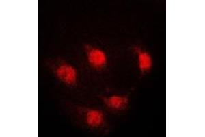 Immunofluorescent analysis of STAT5A staining in K562 cells. (STAT5A Antikörper  (Center))