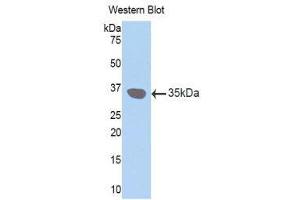 Western Blotting (WB) image for anti-Gap Junction Protein, beta 3, 31kDa (GJB3) (AA 210-270) antibody (ABIN1174655) (Connexin 31 Antikörper  (AA 210-270))