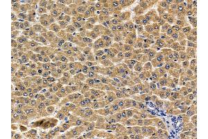 ABIN6256887 and ABIN6274764 at 1/100 staining rat liver tissue by IHC-P. (TROVE2 Antikörper  (N-Term))