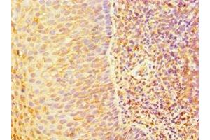 Immunohistochemistry (IHC) image for anti-Transporter 1, ATP-Binding Cassette, Sub-Family B (MDR/TAP) (TAP1) (AA 524-808) antibody (ABIN7144328)