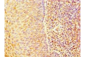 Immunohistochemistry of paraffin-embedded human tonsil tissue using ABIN7144328 at dilution of 1:100 (TAP1 Antikörper  (AA 524-808))