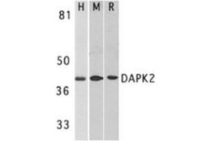 Western blot analysis of DAPK2 in A431 (H), mouse spleen (M), and rat kidney (R) lysates with AP30272PU-N DAPK2 antibody at 1 μg/ml. (DAPK2 Antikörper)