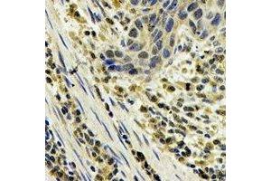 Immunohistochemistry (IHC) image for anti-S100 Calcium Binding Protein A8 (S100A8) antibody (ABIN7308306) (S100A8 Antikörper)
