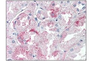 Immunohistochemistry: GPR146 antibody staining of Formalin-Fixed, Paraffin-Embedded Human Kidney. (GPR146 Antikörper  (Internal Region))