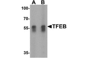 Western blot analysis of TFEB in A549 cell lysate with TFEB antibody at (A) 1 and (B) 2 ug/mL. (TFEB Antikörper  (N-Term))