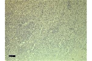 (ABIN334381) Negative Control showing staining of paraffin embedded Human Spleen, with no primary antibody. (CXCR3 Antikörper  (C-Term))