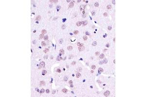 A staining YY1 in Rat brain tissue sections by Immunohistochemistry (IHC-P - paraformaldehyde-fixed, paraffin-embedded sections).