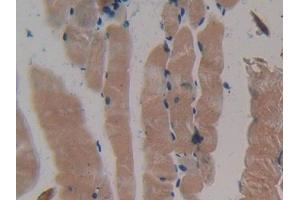 DAB staining on IHC-P; Samples: Mouse Skeletal muscle Tissue (MYH2 Antikörper  (AA 1238-1472))