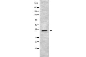 Western blot analysis of MAGA2 using 293 whole cell lysates (MAGEA2B Antikörper  (C-Term))