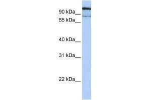 GAA antibody used at 1 ug/ml to detect target protein. (GAA Antikörper  (N-Term))