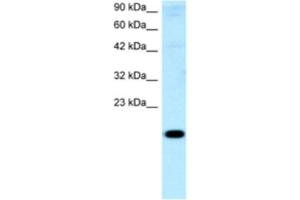 Western Blotting (WB) image for anti-Cbp/p300-Interacting Transactivator, with Glu/Asp-Rich Carboxy-terminal Domain, 1 (CITED1) antibody (ABIN2460540) (CITED1 Antikörper)
