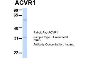 Host:  Rabbit  Target Name:  ACVR1  Sample Type:  Human Fetal Heart  Antibody Dilution:  1.