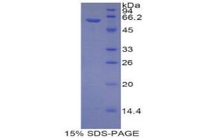 SDS-PAGE (SDS) image for Reprimo (RPRM) (AA 1-109) protein (His tag,MBP tag) (ABIN1878100)