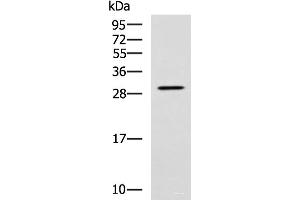 Western blot analysis of SP20 cell lysate using LRAT Polyclonal Antibody at dilution of 1:800