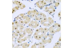 Immunohistochemistry of paraffin-embedded human stomach using SMEK1 antibody. (SMEK1 Antikörper  (AA 395-594))