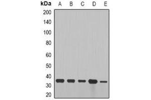 Western blot analysis of Cyclin D2 expression in SW480 (A), NIH3T3 (B), mouse brain (C), mouse lung (D), rat heart (E) whole cell lysates. (Cyclin D2 Antikörper)