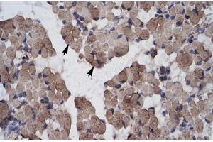 Immunohistochemical staining (Formalin-fixed paraffin-embedded sections) of human muscle with LHX9 polyclonal antibody .