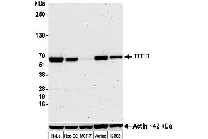 Western Blotting (WB) image for anti-Transcription Factor EB (TFEB) (C-Term) antibody (ABIN7795623)