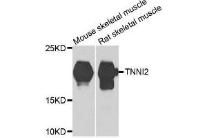 Western blot analysis of extracts of various cell lines, using TNNI2 antibody. (TNNI2 Antikörper  (AA 1-100))