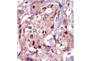 Image no. 2 for anti-Nuclear Receptor Subfamily 4, Group A, Member 3 (NR4A3) (Middle Region) antibody (ABIN2853628)