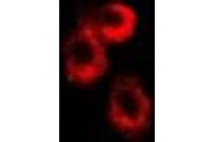Immunofluorescent analysis of RISP staining in U2OS cells. (UQCRFS1 Antikörper)