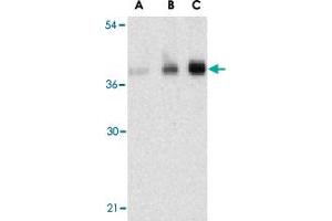 Western blot analysis of C1QTNF5 in human brain tissue lysate with C1QTNF5 polyclonal antibody  at (A) 1, (B) 2, and (C) 4 ug/mL . (CTRP5 Antikörper  (N-Term))