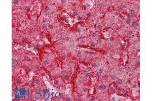 Immunohistochemistry (IHC) image for anti-Arginase, Liver (ARG1) (C-Term) antibody (ABIN570917)