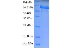 SDS-PAGE (SDS) image for Transmembrane Protease, serine 4 (TMPRSS4) (AA 52-435) protein (His-SUMO Tag) (ABIN5711624)