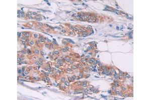 Used in DAB staining on fromalin fixed paraffin- embedded Kidney tissue (TPM2 Antikörper  (AA 1-284))
