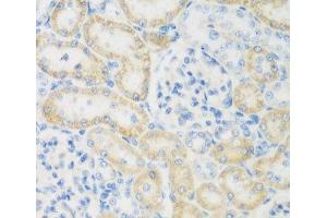 Immunohistochemistry of paraffin-embedded Rat kidney using NAT8B Polyclonal Antibody at dilution of 1:200 (40x lens). (NAT8B Antikörper)