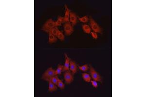 Immunofluorescence analysis of PC-12 cells using T Rabbit pAb (ABIN6130537, ABIN6143503, ABIN6143504 and ABIN6215581) at dilution of 1:50 (40x lens).