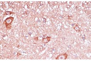 Immunohistochemistry of paraffin-embedded Mouse spinal cord using RPL32 Polyclonal Antibody at dilution of 1:100 (40x lens). (RPL32 Antikörper)